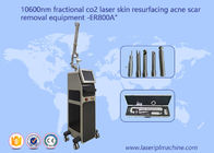 10600nm koel de Lasermachine van Straal Verwaarloosbare Co2 voor de Zwangerschapsstreepverwijdering van het Acnelitteken