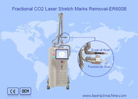 Het Aftasten 10600nm 10x10mm van de littekenverwijdering Verwaarloosbare Co2-Lasermachine