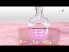 MLS05 de draagbare 40K-Cavitatie Vacuümrf Ultrasone Cellulite vermindert Apparaat