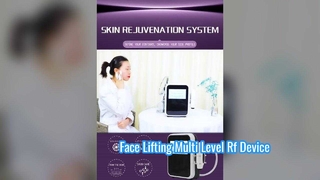 Niet-invasief 60W-oogverzorging Gladde fijne lijntjes Radiofrequentie-apparaat met meerdere niveaus