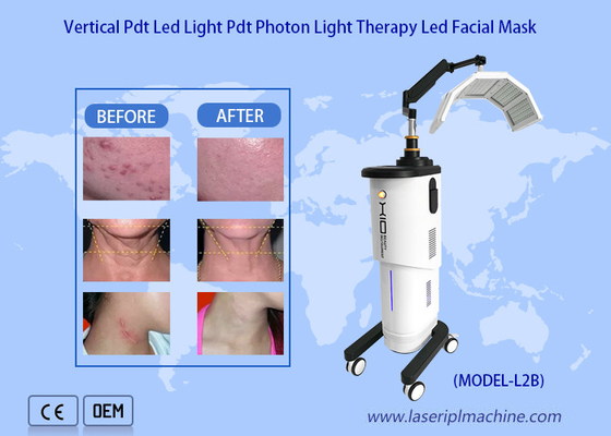 Nieuwste Bio Licht Therapie Huid Verjonging 650nm Photodynamische Machine
