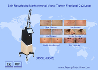 Effectieve fractionele laser CO2 machine voor vaginale behandeling