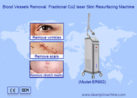 RF Fractionele CO2-laser voor striae litteken verwijdering Vaginale strenger machine
