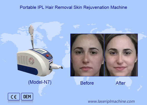 Geavanceerde IPL laser ontharing en huidverjonging met geïmporteerde saffier lichtkristal