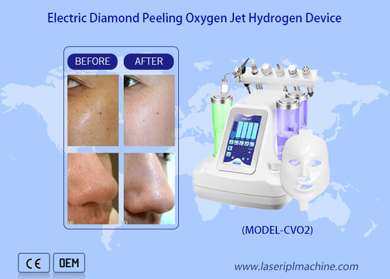 Gezichtsreiniging Water Oxygen Jet Peeling Machine / hydro Dermabrasie Water Oxygen Jet Deep Skin Reiniging