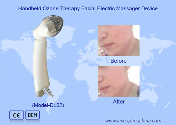 Handheld ozontherapie gezichtsmassageapparaat voor het verwijderen van rimpel acne