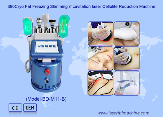 360 Cryo Vacuum Rf Lipo Laser 6 In 1 Vet Bevriezing Gewichtsverlies Lichaamsverminderingsmachine