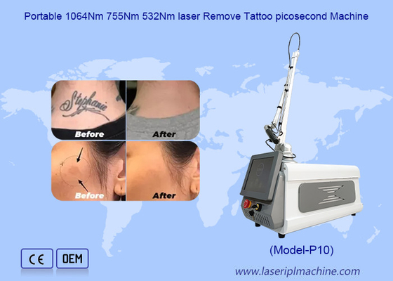 Draagbare huid whitening Picosecond tatoeage verwijdering Nd Yag laser machine