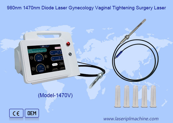 980nm 1470nm Diode Laser  Gynecology  Vaginale  Vagina  Aanscherping  Chirurgie Laser