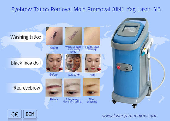 Goede prijs 1064nm 532nm Nd Yag Laser Tattoo Removal Machine Dermatologie online