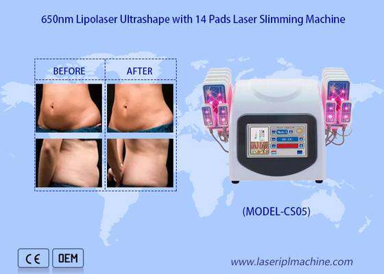 de Laser van 650nm Lipo vult de Machine van Laserliposuction voor op vermindert de Vette Verwijdering van Cellulite