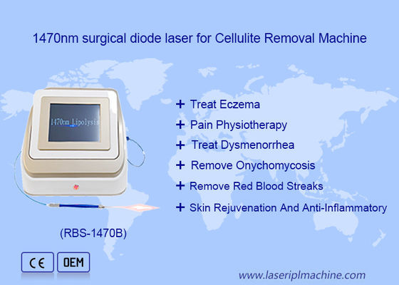 Goede prijs 1470nm 980nm Diode Laser Lipolyse Chirurgie Laserapparaat Vetoplosbaar online