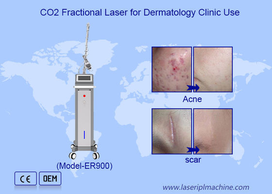 Goede prijs 10600nm Fractionele Ultrapulsed Co2 Laser Skin Resurfacing Machine online