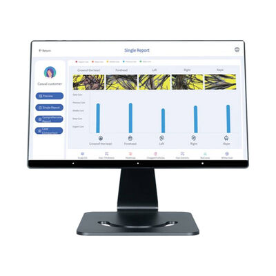 Goede prijs 4 talen Smart Al Scalp Analyzer Hair Scalp Care Targeted Head Machine online